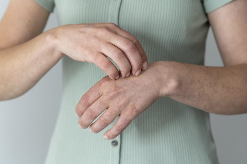 Psoriatic Arthritis Symptoms